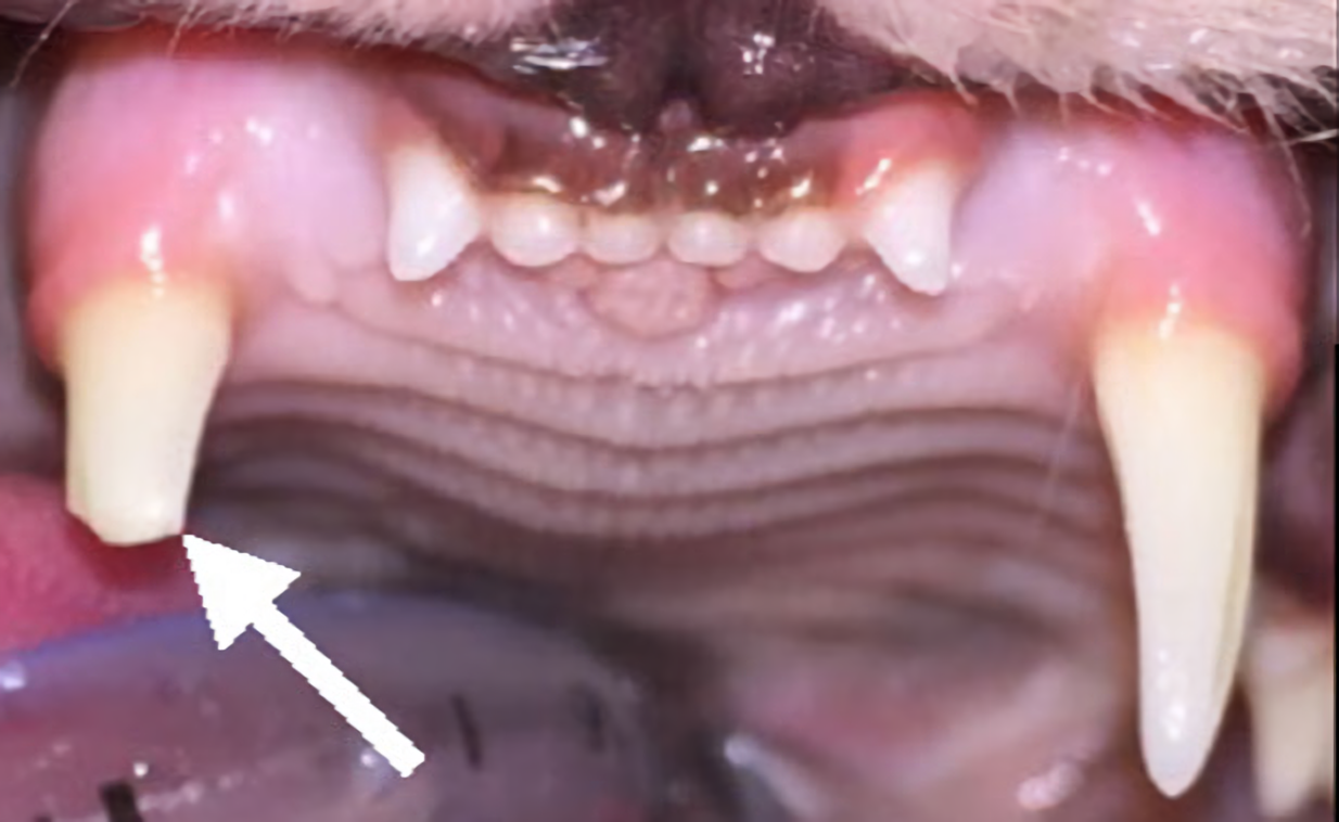 brooken-tooth