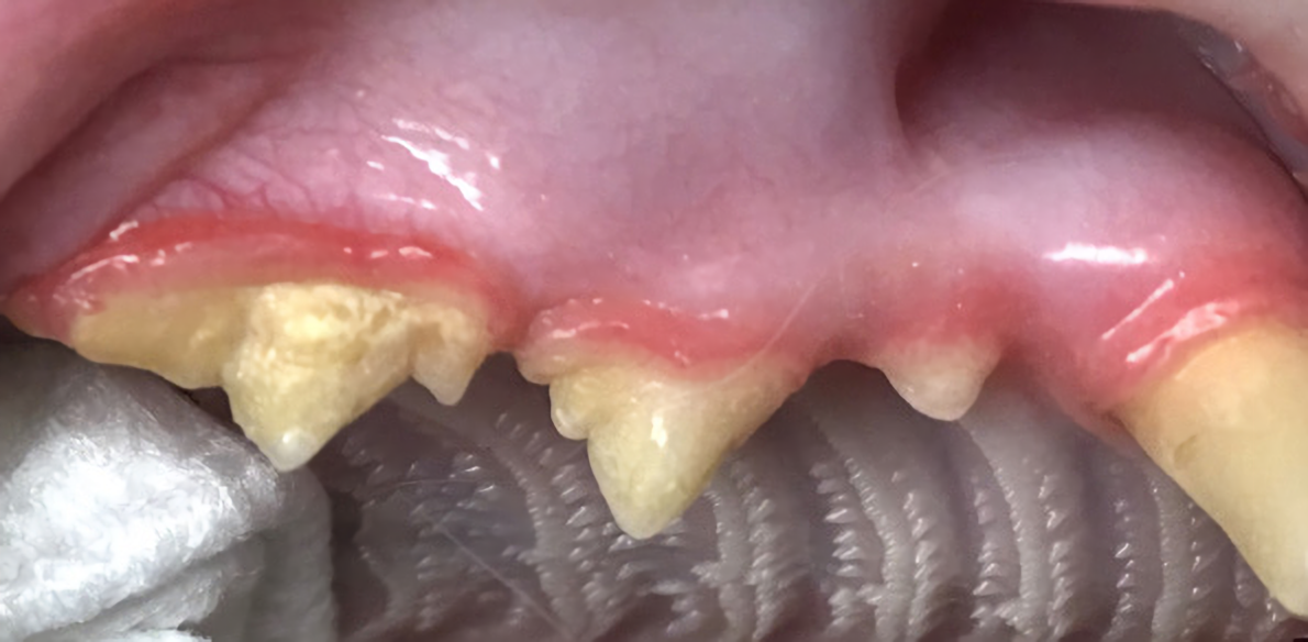 reobsorbing teeth
