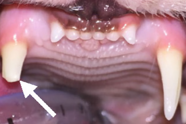 brooken-tooth